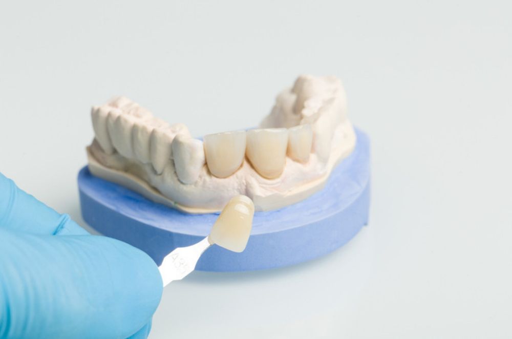 A patient in the dental chair