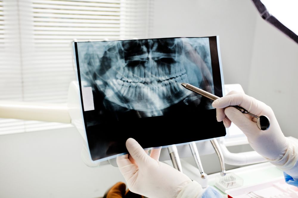 A dentist pointing at a panoramic dental x-ray